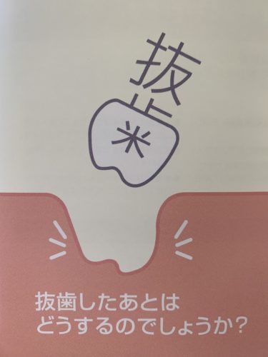 親知らずと神経が近いために、抜けないと言われた方へ | 院長 ...