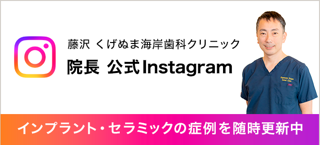 藤沢 くげぬま海岸歯科クリニック院長公式Instagram インプラント・セラミックの症例を随時更新中